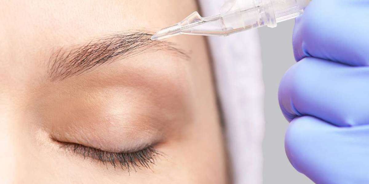 Can Eyebrow Transplants Be Reversed or Redone?