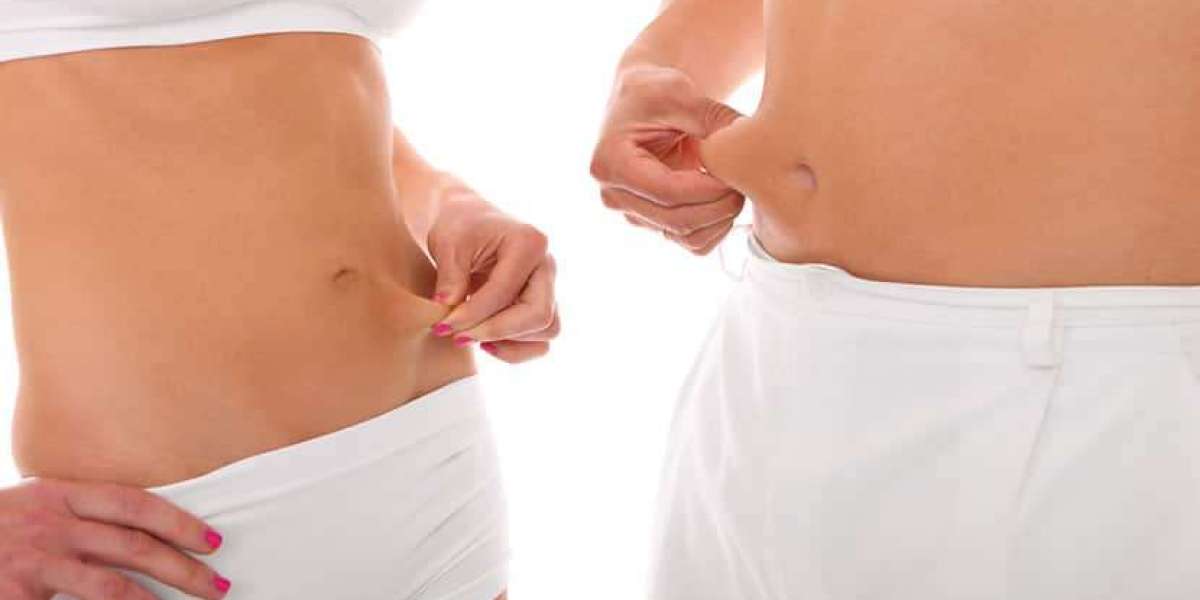 Fat Transfer Surgery: Natural and Minimally Invasive