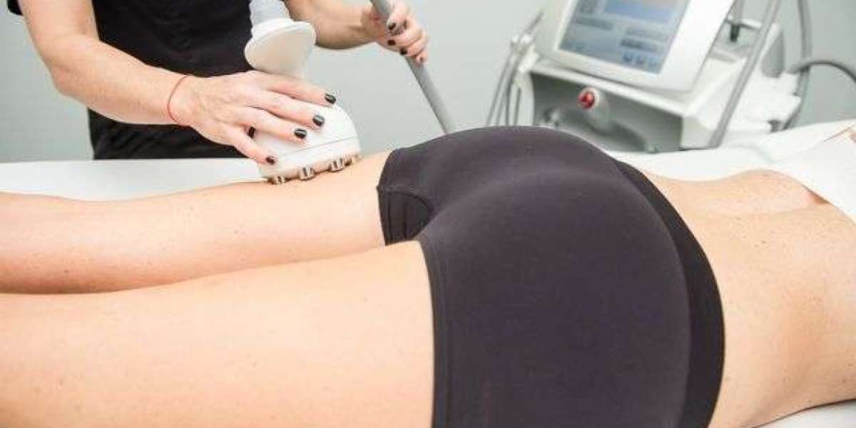 How Does Cupping Therapy Help with Cellulite?