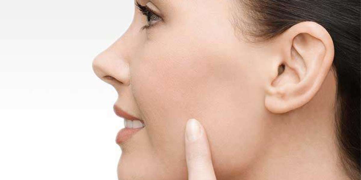 Buccal Fat Removal Surgery Key Benefits Explained