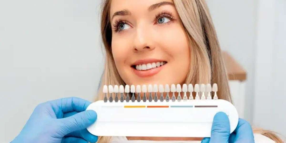 Laser Teeth Whitening Benefits: Is It Worth Considering?