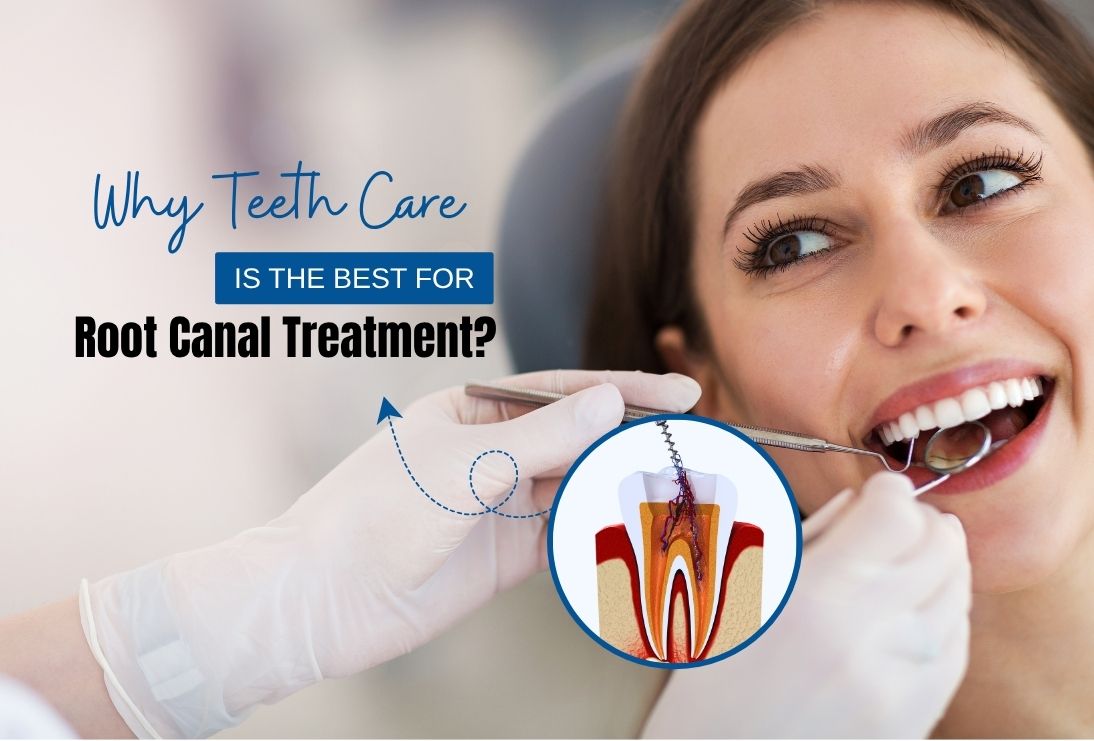Painless Root Canal Treatment at Teeth Care Kolkata | Teethcare