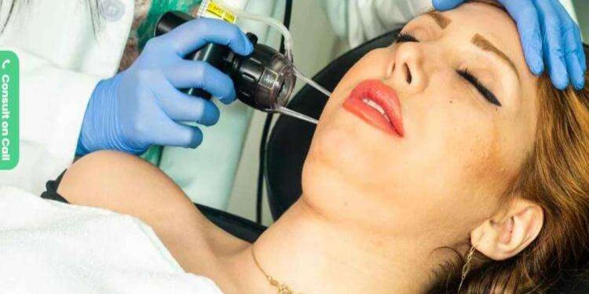 Discover Laser Hair Removal in Bangalore: A Long-Term Solution to Smooth, Hair-Free Skin