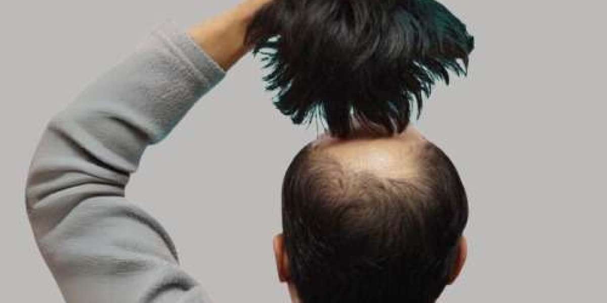 Hair Wigs in Islamabad for Everyday Elegance