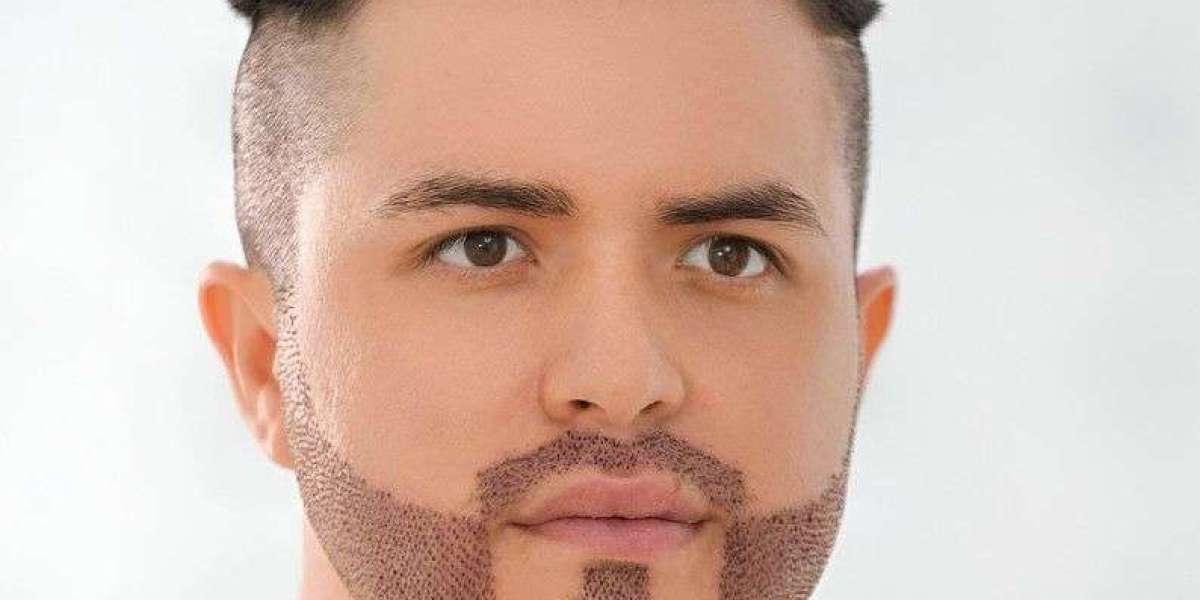 Beard Hair Transplant for Thin Beards