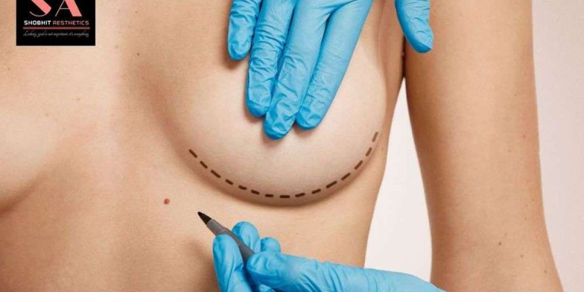 Breast Implant Surgery Cost in Delhi: A Complete, Expert-Led Guide for Informed Decisions