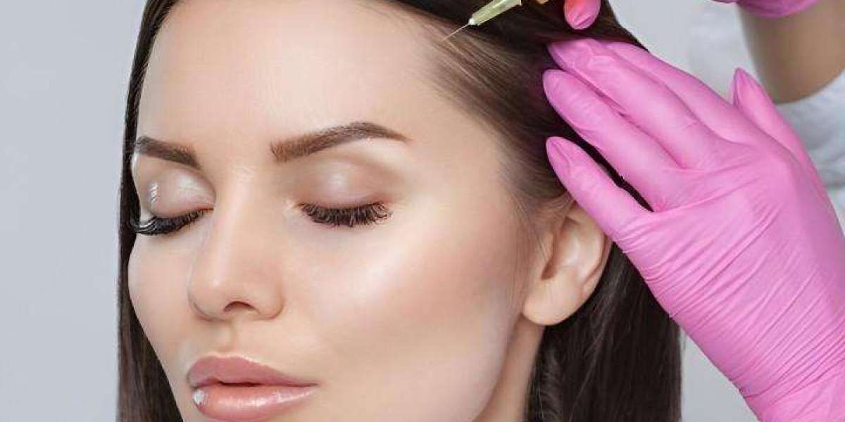 PRP Hair Treatment in Islamabad for Advanced Regrowth Therapy