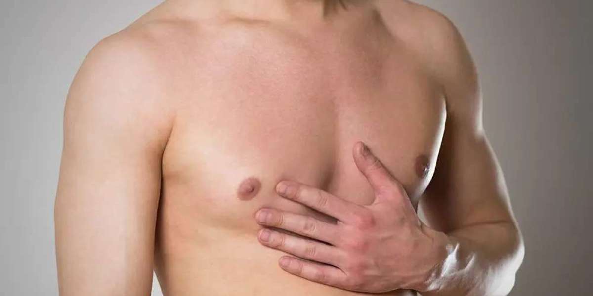 What Is the Typical Recovery Timeline for Gynecomastia in Dubai?