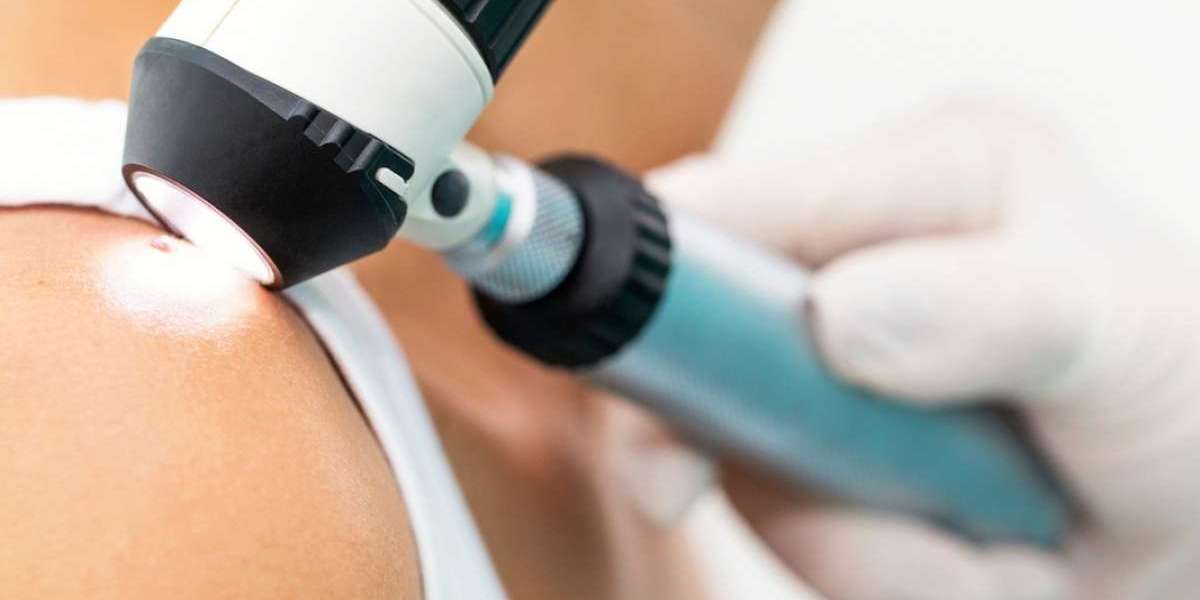 How Accurate Is Dermoscopy For Mole Evaluation In 2026?