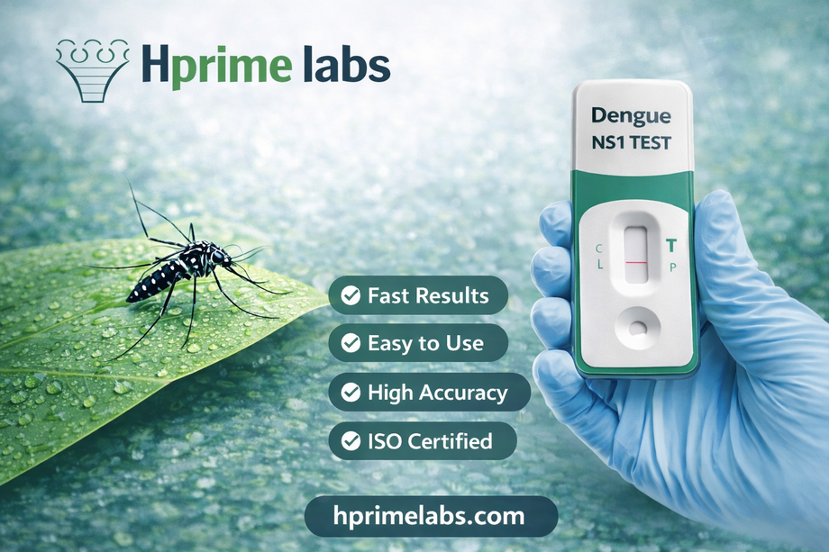 Dengue NS1 Test: Fast and Accurate Early Dengue Diagnosis - JustPaste.it