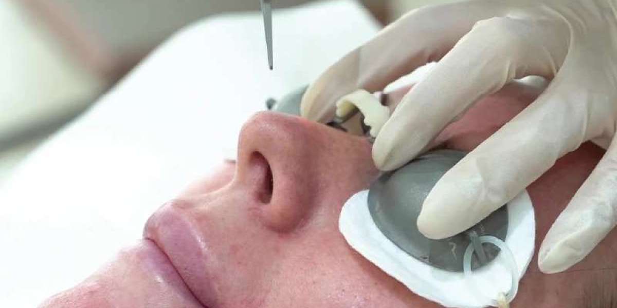 Can Picosure Laser Treatment Elevate Skin Smoothness Instantly?