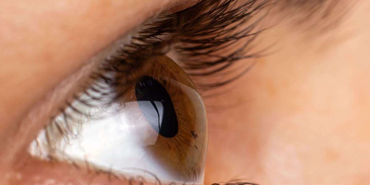Top 5 Signs You Need an Eye Checkup – Expert Advice from Mulund’s Leading Clinic