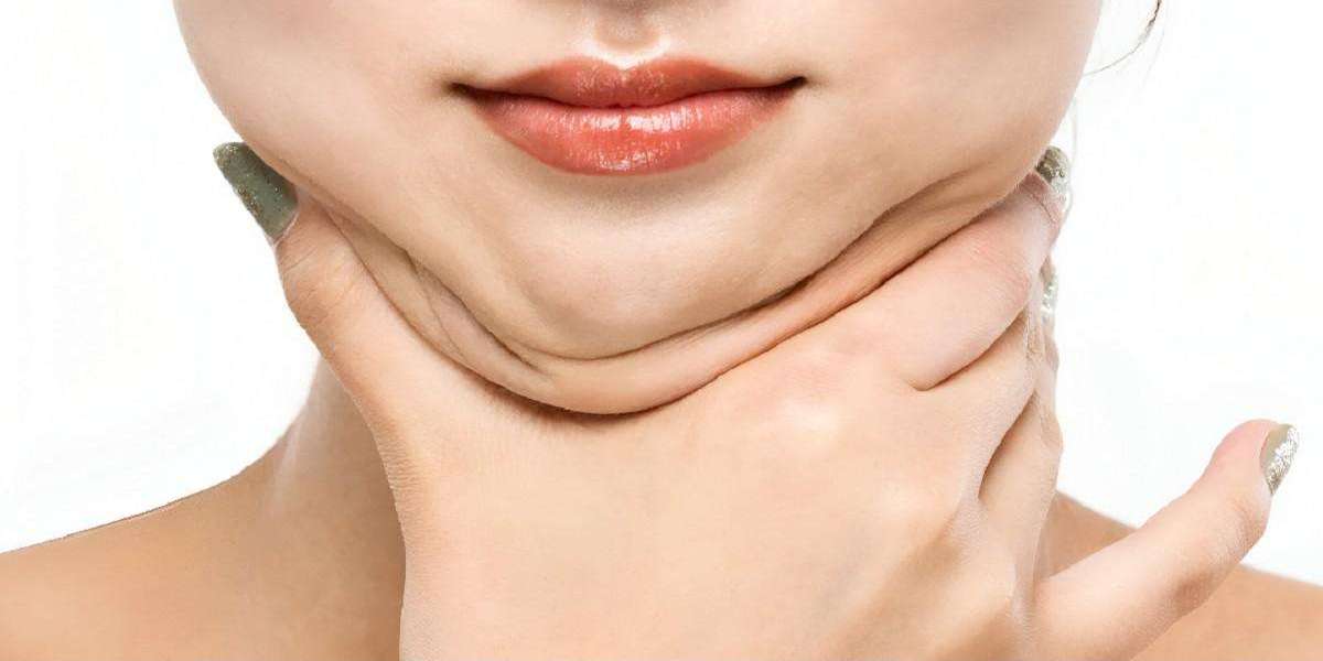 Double Chin Liposuction in Islamabad for Jaw Confidence
