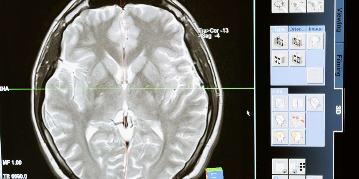 How a Greenville Personal Injury Attorney Proves Fault in Traumatic Brain Injury Cases