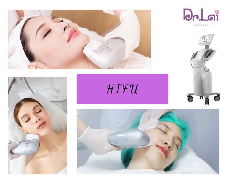 Công nghệ Hifu: Trẻ hóa làn da không cần phẫu thuật