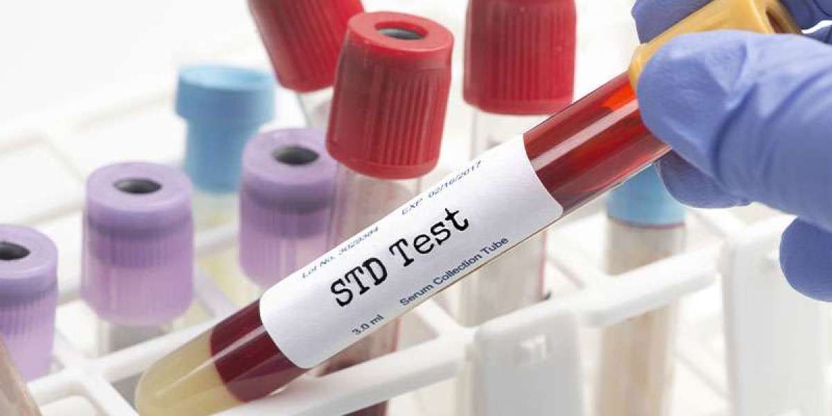 Preparing Mentally for an STD Test in Dubai: Tips and Guidance