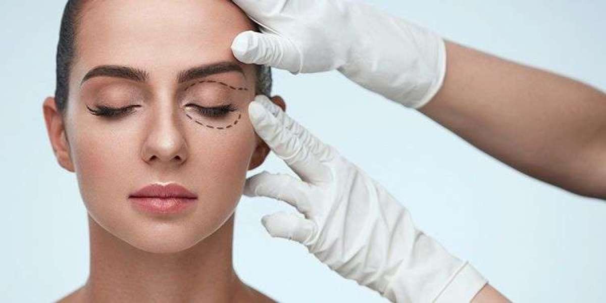 How Do Surgeons Determine Candidacy for Eyelid Surgery or Blepharoplasty?