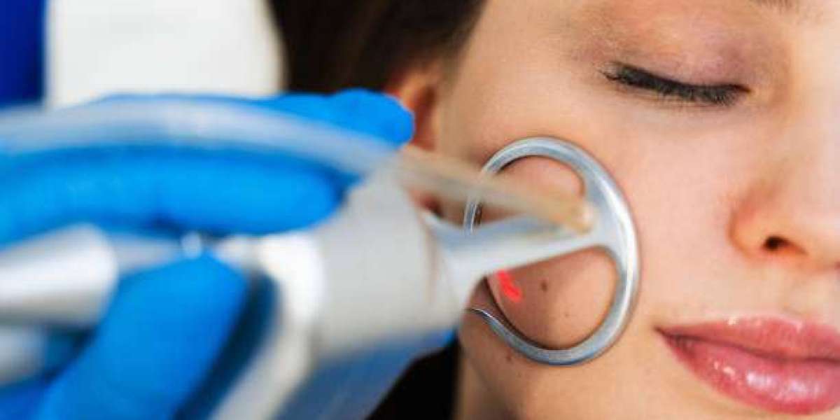 How to Choose Large Pores Treatment in Dubai for Your Skin Type