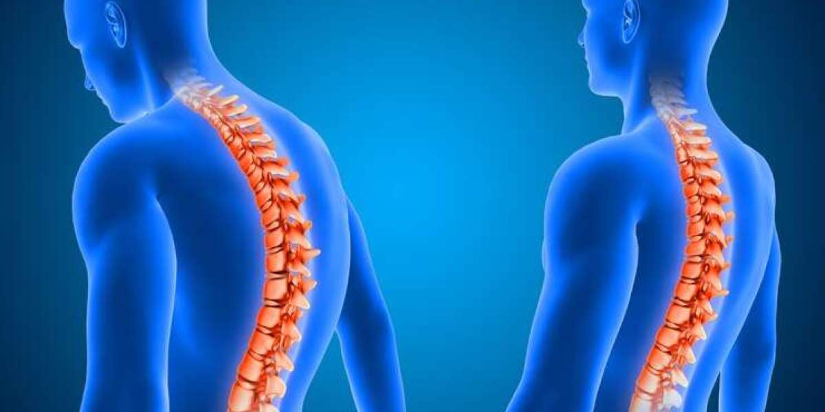 Effective Slipped Disc Treatment in Faridabad for Long-Term Back Pain Relief