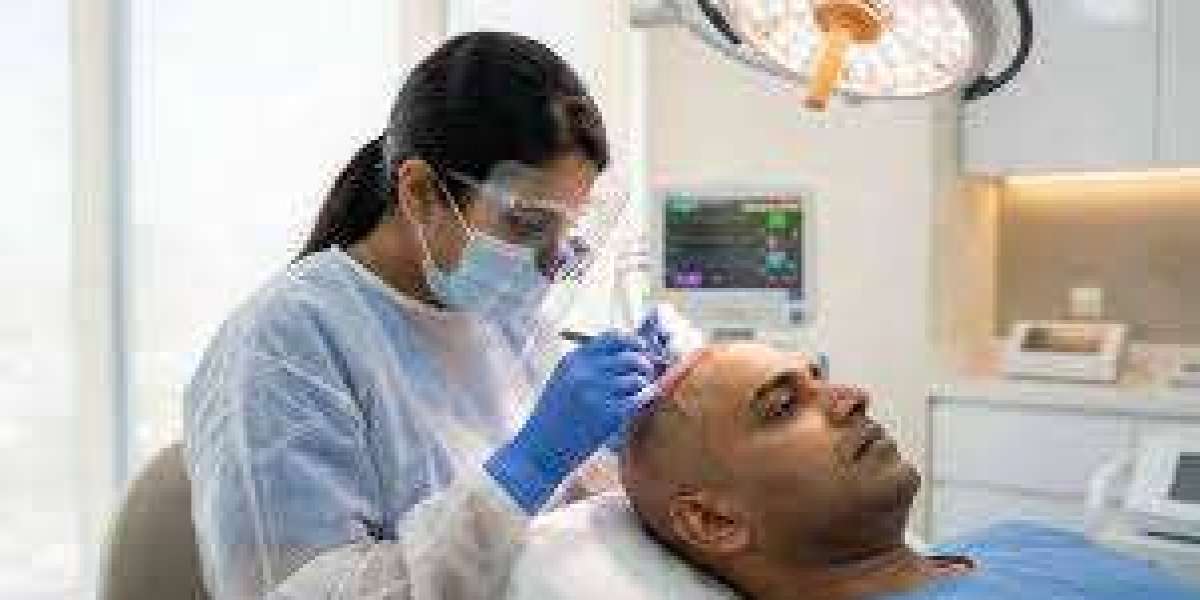 Best Hair Doctor in Bangalore: Consultation and Evaluation Guide