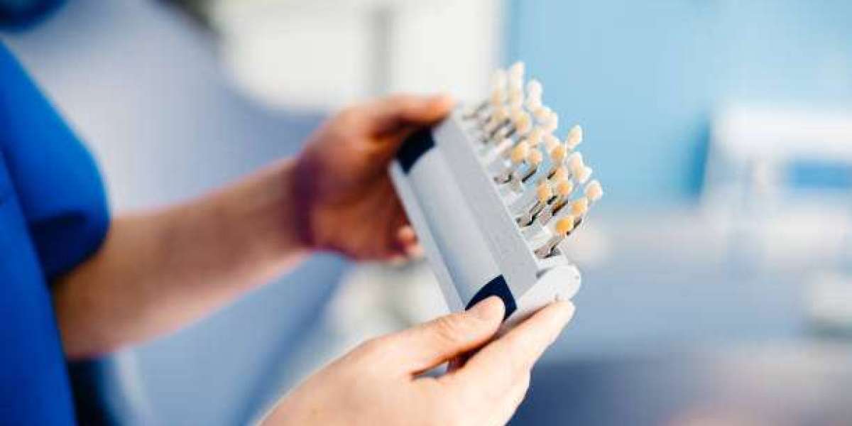 Enhance Your Natural Smile with Dental Veneers in Islamabad