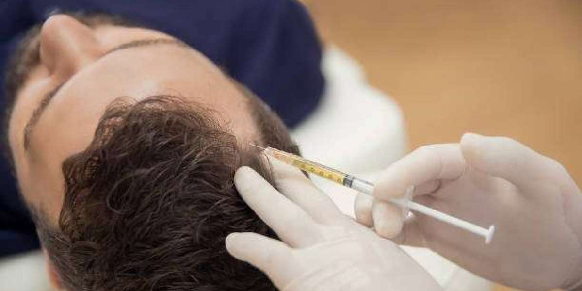 Proven Hair Restoration Strategies in Islamabad for Natural and Lasting Growth