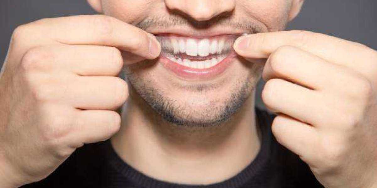 Achieve a Brighter, Healthier Smile with Teeth Whitening in Islamabad